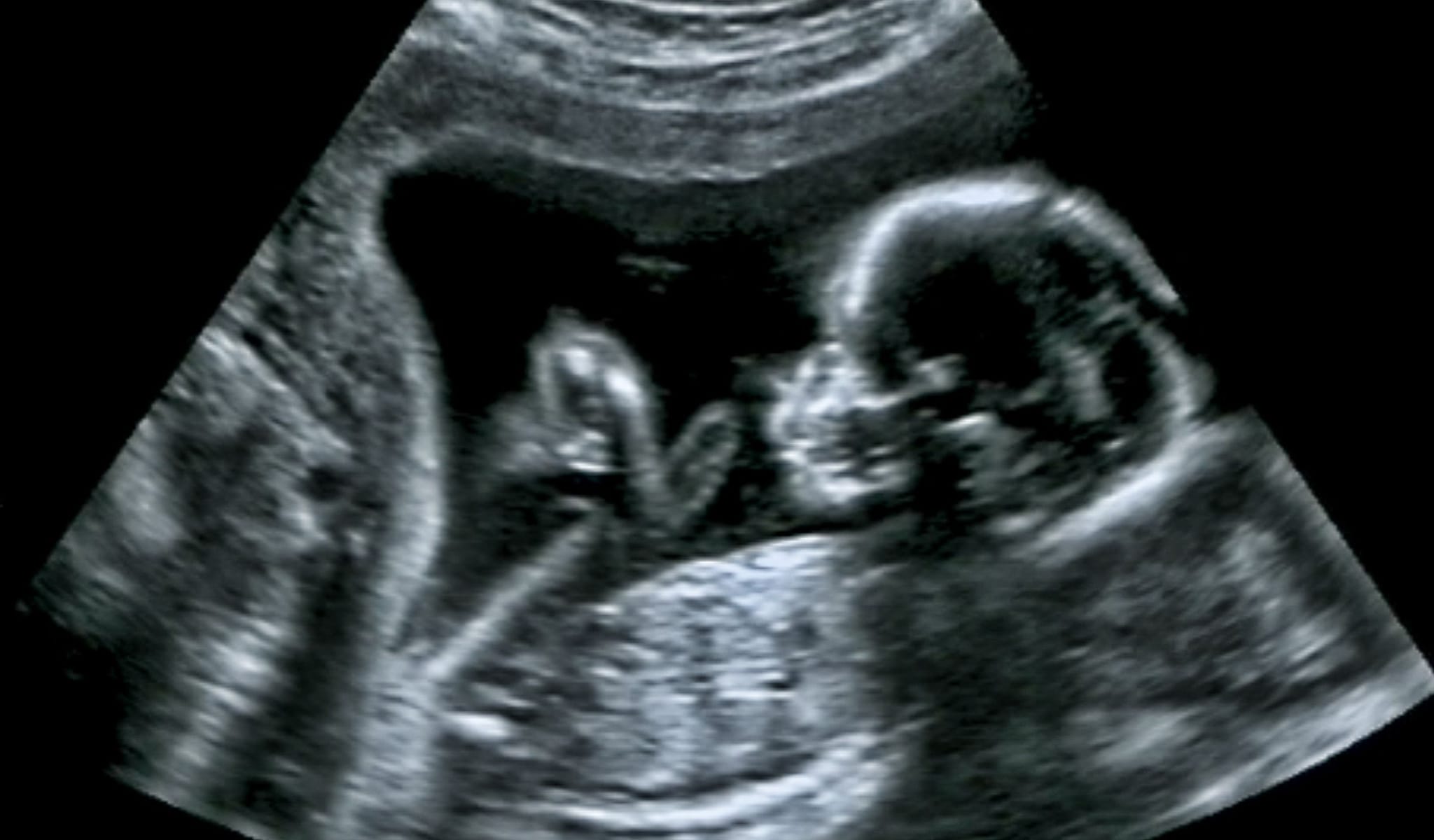 pfizer pregnancy