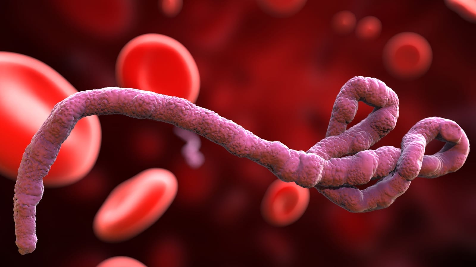 Ebola in DRC: The Reality and the Media Hype